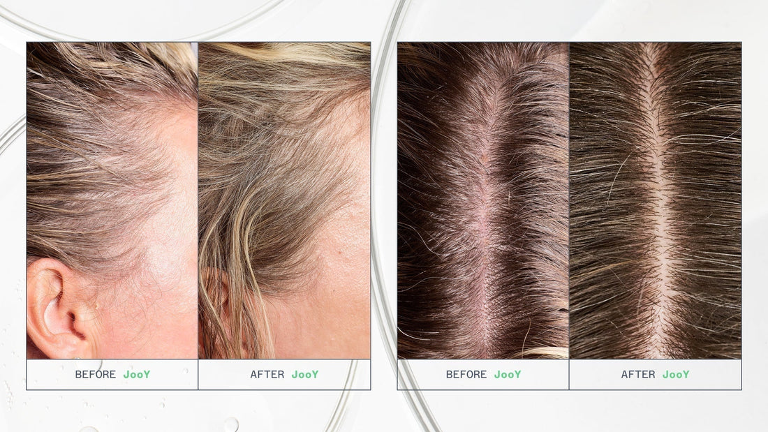 Why Scalp Care Is the Secret Weapon in Every Great Hair Routine